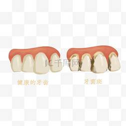 口腔牙齿牙菌斑医疗健康牙科