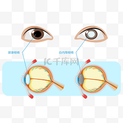 老年人眼睛图片_白内障老年疾病
