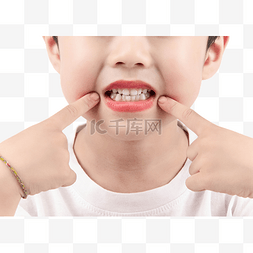 儿童牙图片_儿童牙齿矫正