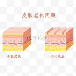 皮肤老化问题剖面图对比