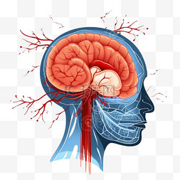 医生急救卡通图片_人脑中风的科学医学图解