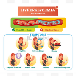 高血糖向量插图集合集。孤立的症