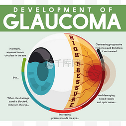 与未经治疗的青光眼疾病发展的信