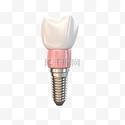 3d 牙龈与牙种植体隔离 3d 渲染插