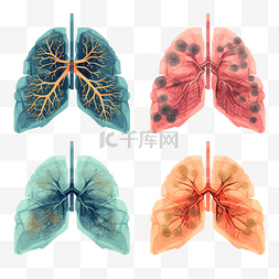 用数对表示数图片_一组感染性肺炎的肺部图形表示
