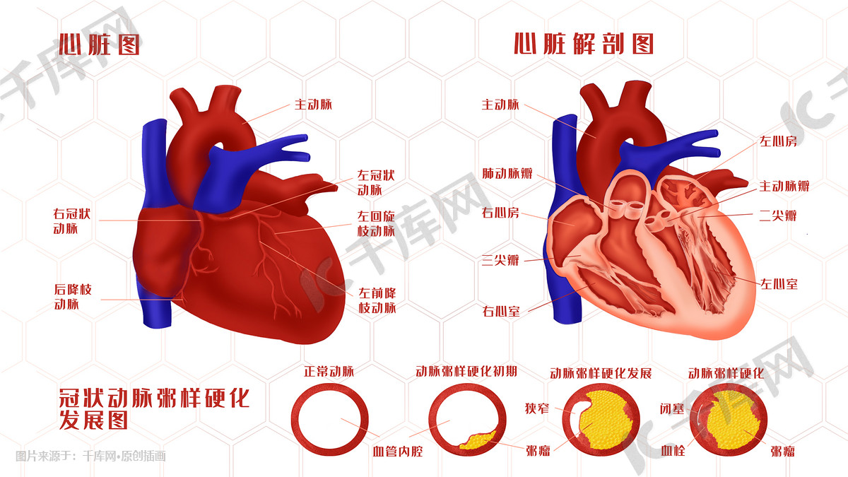 人体器官心脏解剖图及冠状动脉粥样硬化发展