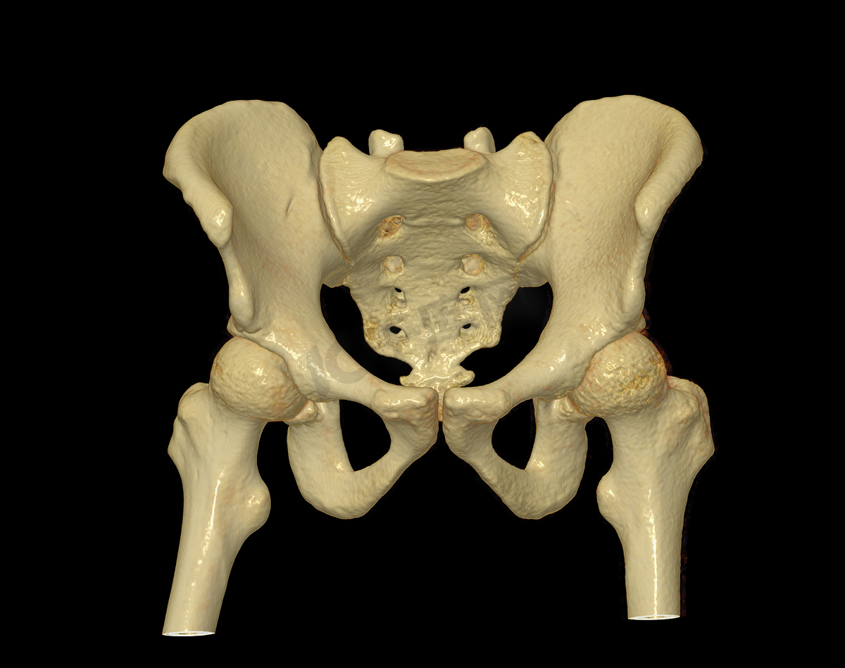 骨盆骨和髋关节 3D 渲染的 CT 扫描，用于诊断黑色背景下骨盆骨和髋关节骨折。图片