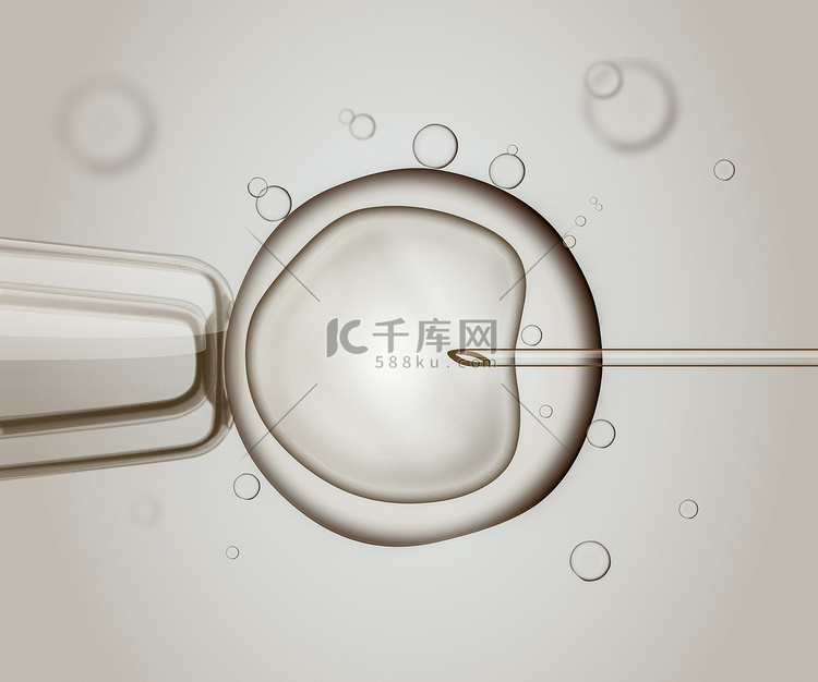 宏的 Ivf (体外受精)。受