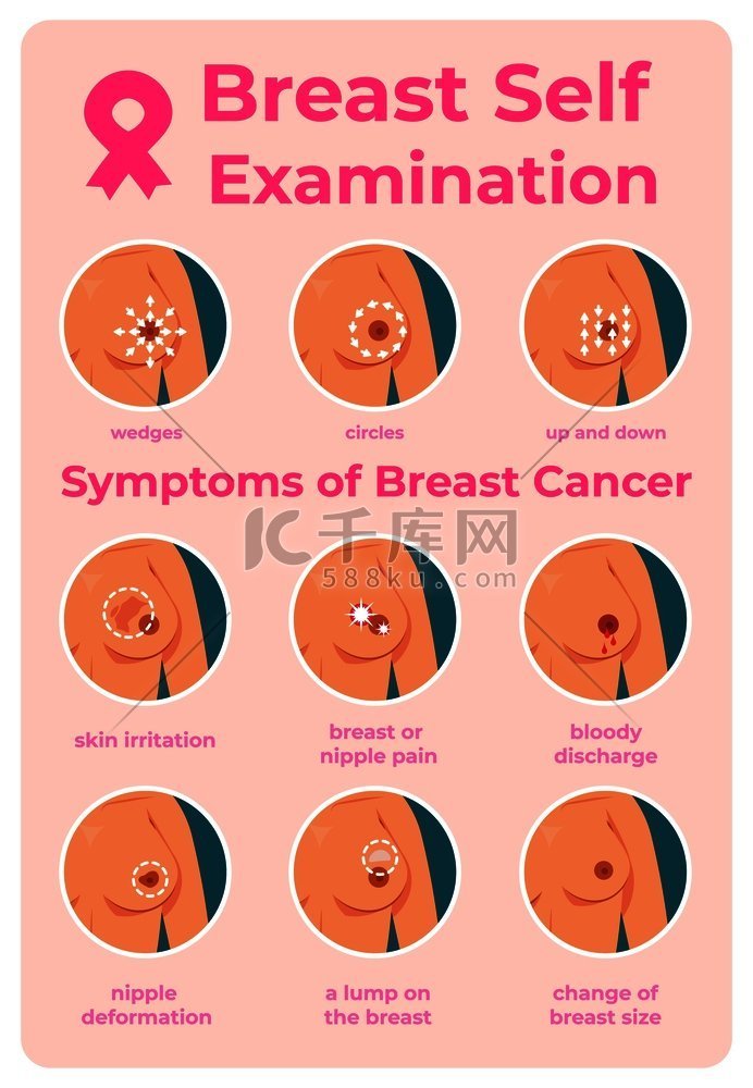 乳腺癌检查。