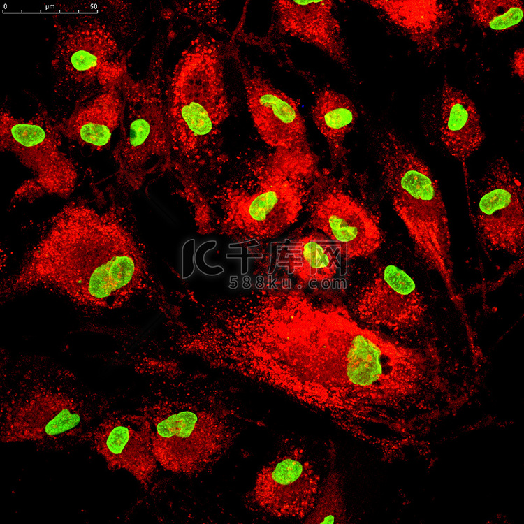 荧光分子标记的骨髓间充质干细胞