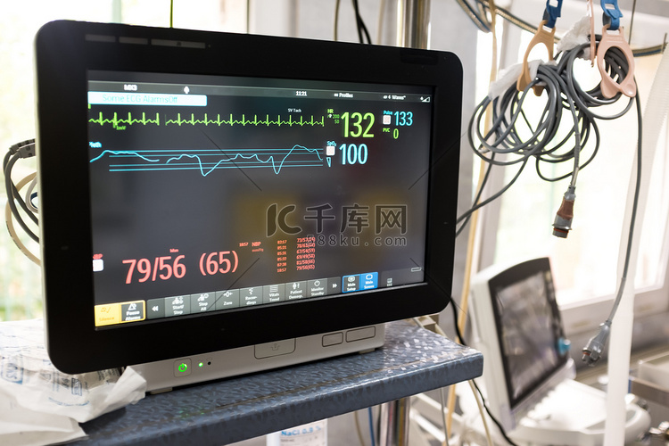 医院急诊室心电图机监测仪