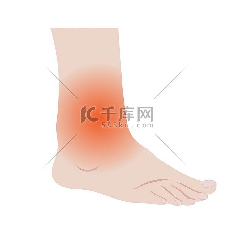 脚和脚踝因感染或受伤而肿胀