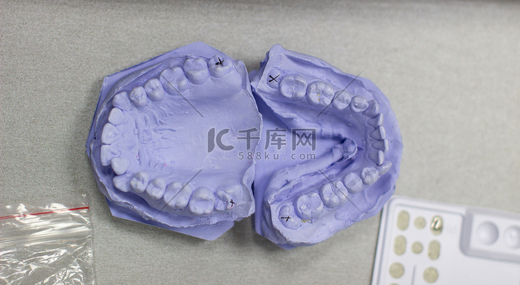 在正畸医生处用石膏制成的牙齿石