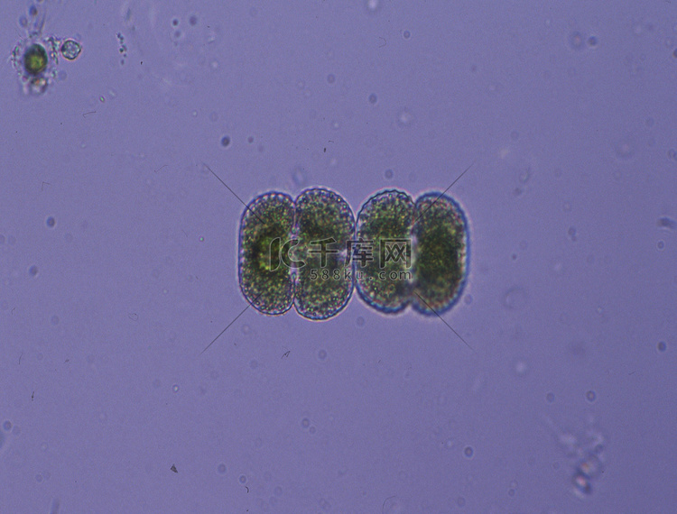 100 倍显微镜下的装饰藻类