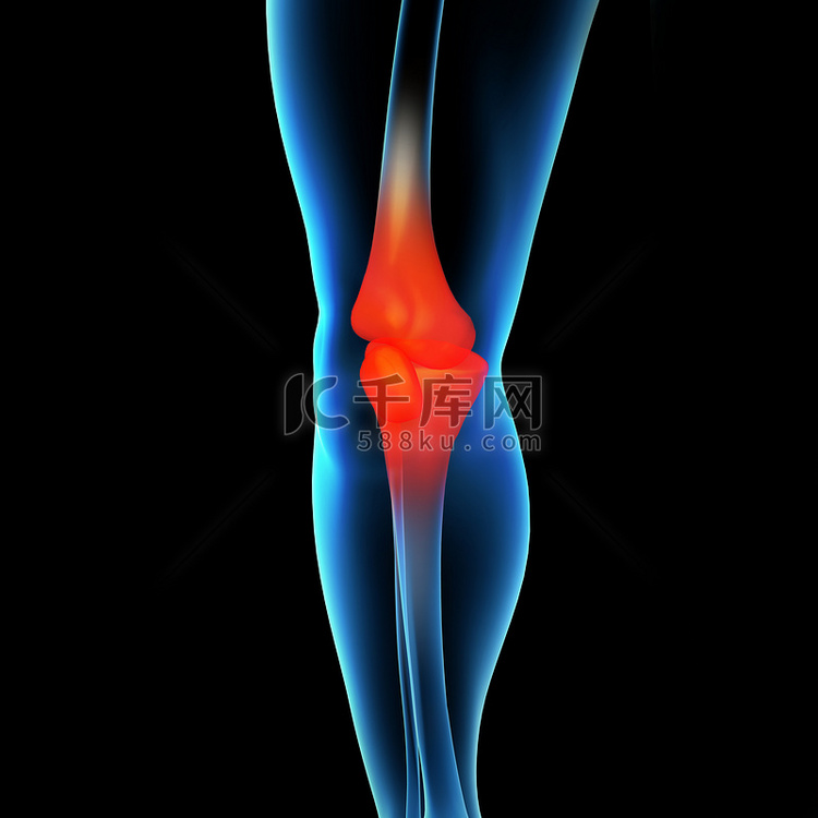 人类膝盖疼痛与骨骼腿的解剖