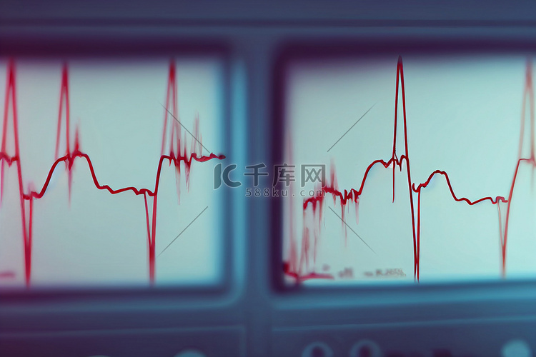 心电图、心电图、心率监测仪显示