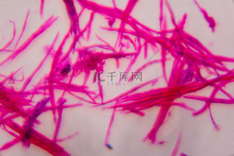 平滑肌在显微镜下分离-抽象粉红