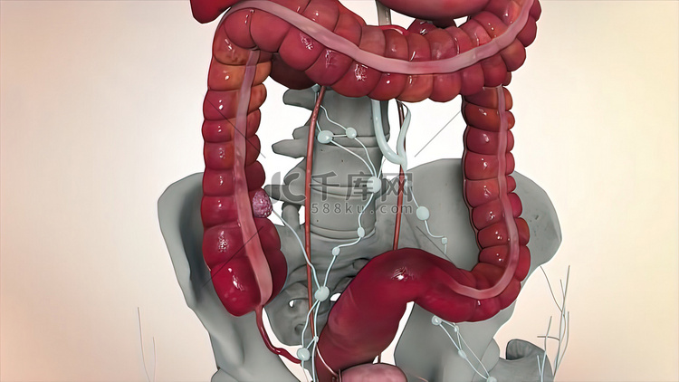 肠镜检查期间的结肠，可见肠或肠