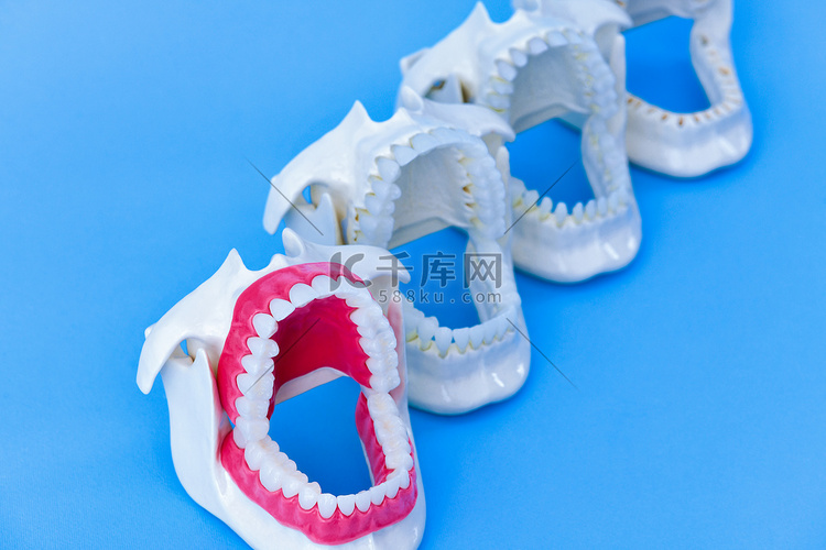 牙医正畸牙齿模型