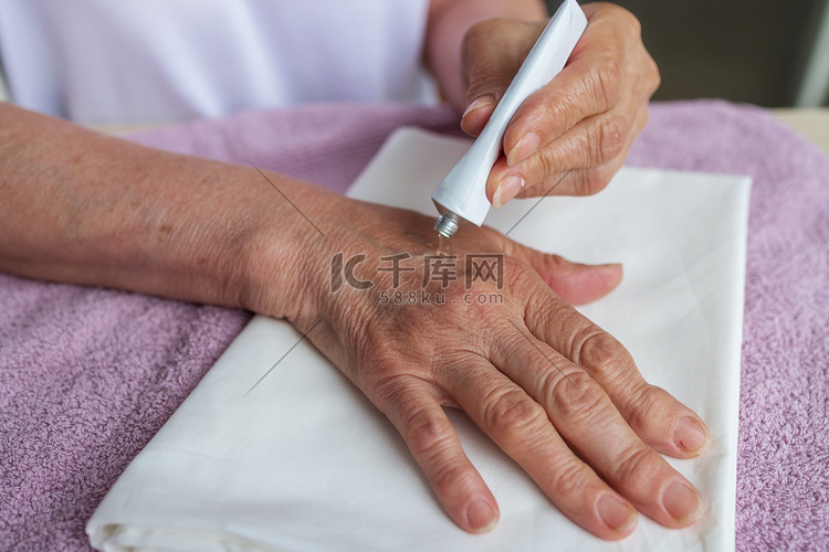一位老妇人在她的老手上涂抹治疗