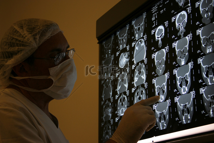 穿着外科手术服的医生看 X 射线