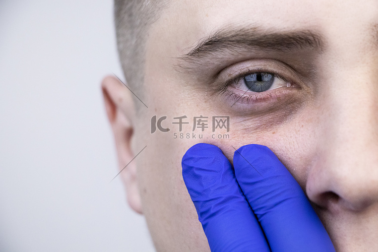 眼皮底下的包，男人脸上的疱疹。