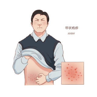 皮肤素描海报模板_常见医疗人物疾病图例带状疱疹