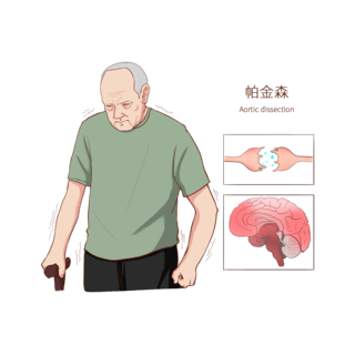 人体结构图海报模板_常见医疗人物疾病图例帕金森