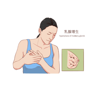 国医皮肤海报模板_常见医疗人物疾病图例乳腺增生