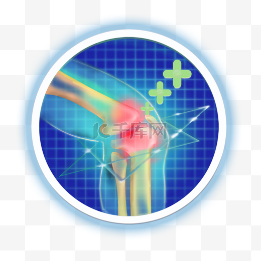 膝关节科技感受伤治疗模型图片