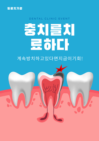 牙齿蛀牙海报模板_牙齿牙龈发炎治疗海报