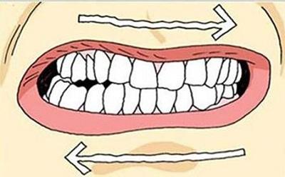 牙齿位置图配乐音频素材_牙齿磨牙的声音音效
