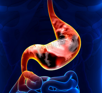 血人体摄影照片_胃部胃癌科技透视解剖图