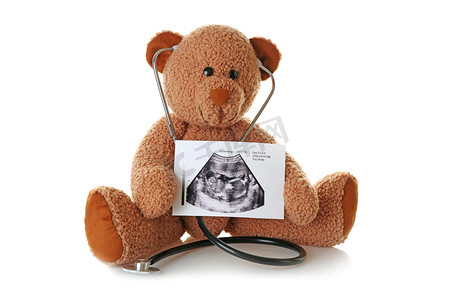 超声扫描的婴儿与听诊器在白色背景上的玩具熊