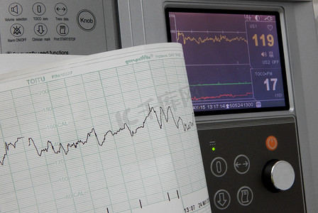 信号科技摄影照片_心电图固定和印刷的心率图