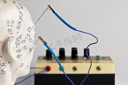 电针针灸法中医保健服务