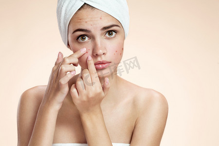 痤疮现货疙瘩现货护肤美容护理女孩按皮肤问题脸上。女人的皮肤瑕疵孤立，米色背景。美丽年轻的白人女性模型