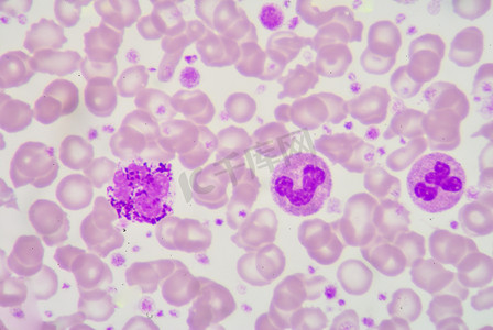 异常细胞摄影照片_中性粒细胞及嗜碱性粒细胞