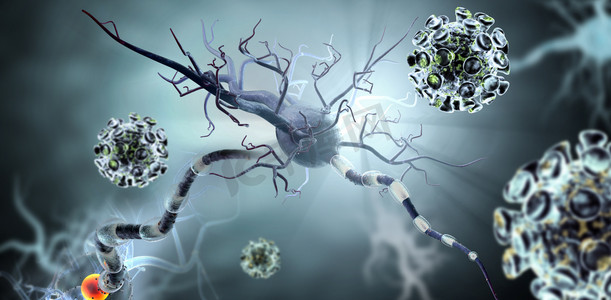 病毒小游戏摄影照片_高质量三维图像处理病毒攻击神经细胞、 神经疾病、 肿瘤、 脑手术的概念.