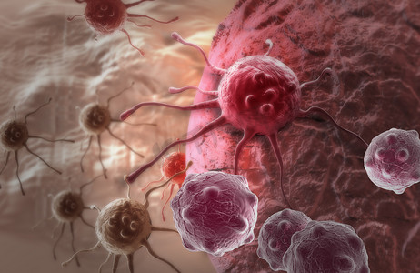 华西肿瘤摄影照片_癌症细胞