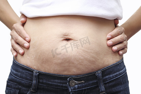 肚子饿摄影照片_亚洲女子展示她的妊娠纹