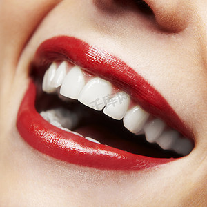 女人的微笑。牙齿美白。牙科护理服务.