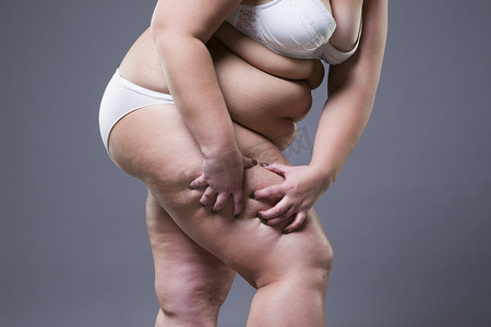 腿部肥胖，肥胖女性身体超重的女人