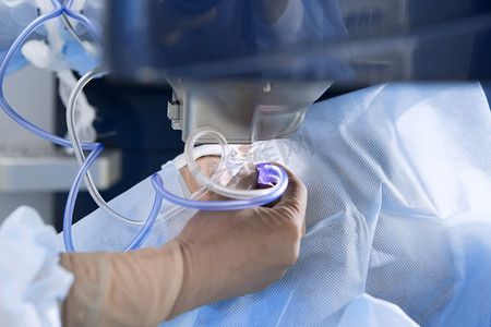 激光手术摄影照片_激光手术治疗视力矫正和白内障摘除术