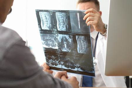 医生手里拿着X射线骨脊放射成像