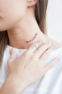 女人的脖子上的刀疤鼹鼠