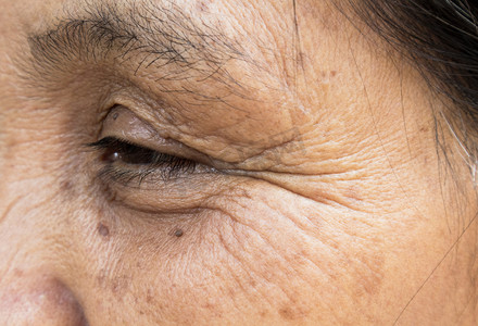 老护理摄影照片_特写的脸皱老女人，衰老，皮肤护理概念