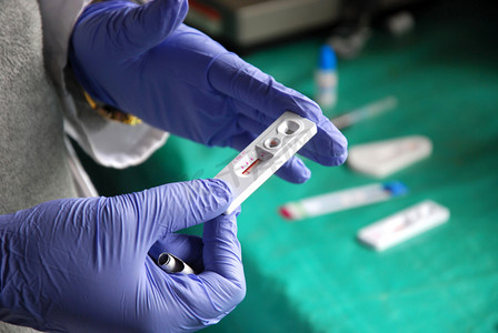 艾滋病毒检测在非洲坦桑尼亚-Pomerini