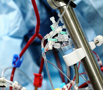 心脏血液摄影照片_人工血液循环装置在重症监护病房