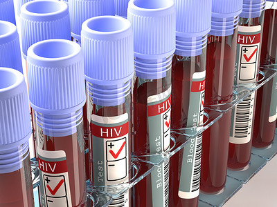 预防艾滋病病毒摄影照片_艾滋病毒测试的结果